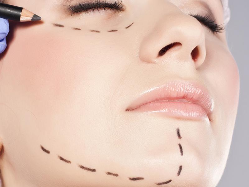 chirurgia estetica facciale